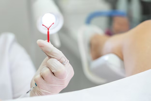 Saúde realiza mutirão de DIU para ampliar acesso ao planejamento reprodutivo